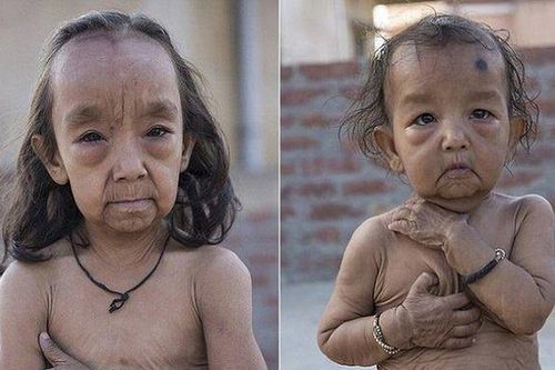 Hai chị em 7 và 18 tháng tuổi mang gương mặt già hơn cả cha mẹ, cuộc sống mỗi ngày gây xót xa