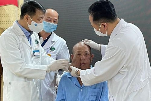 Khối u làm biến dạng khuôn mặt người đàn ông được cắt bỏ