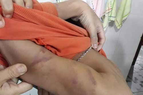Con lớp 1 bị bố bạo hành vì học kém, giật tiền của bạn