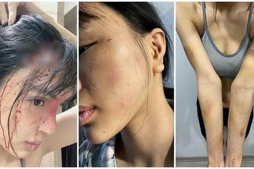 Công an điều tra vụ người mẫu Khả Trang bị chồng chưa cưới hành hung