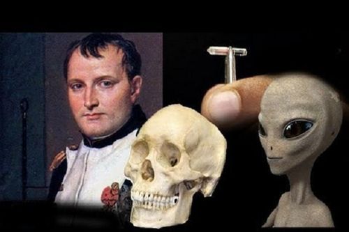 Nóng: Người ngoài hành tinh 'cả gan' cấy vi mạch vào hộp sọ Napoleon?