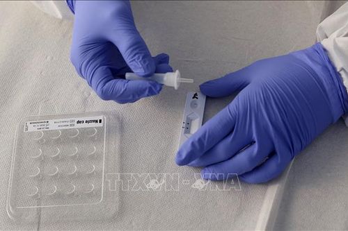 Phát hiện mới giúp chẩn đoán bệnh COVID-19 qua xét nghiệm máu