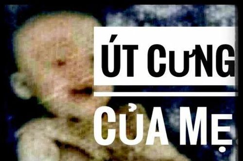 Út cưng của mẹ