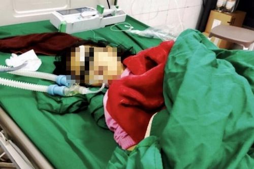 Cứu sống 2 trẻ nguy kịch do tự ý chữa bệnh bằng lá lộc mại