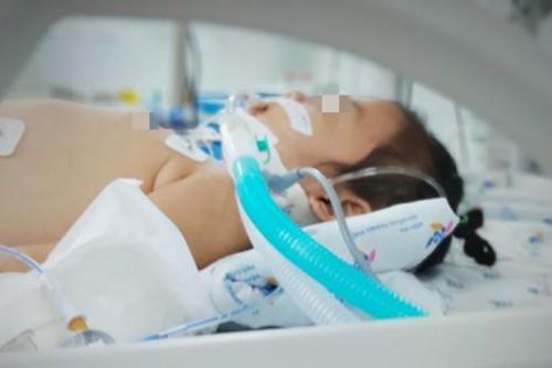 Bé gái nguy kịch vì hội chứng 'công chúa tóc mây'