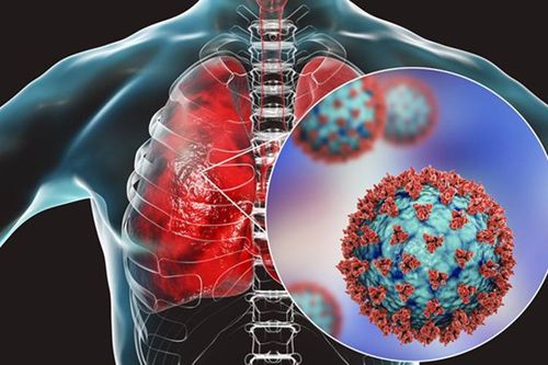 Virus SARS-CoV-2 có khả năng đẩy nhanh tốc độ lão hóa của phôỉTin khácTrải thảm đón nhà đầu tưChung tay phòng chống HIV/AIDS trong bối cảnh dịch COVID-19