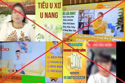 Nhân cái đẹp, dẹp cái xấu