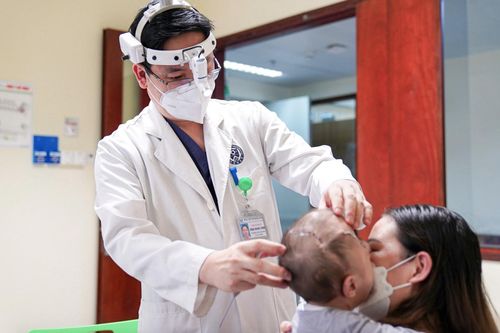 Hộp sọ đóng kín khiến bé gái ngủ không nhắm mắt