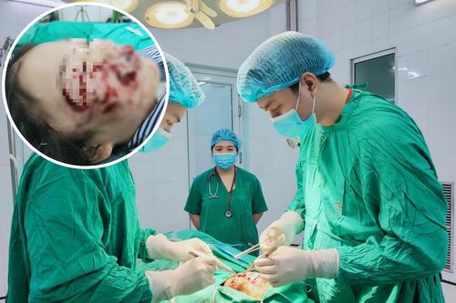 Chó dữ tấn công bất ngờ, 2 cháu bé nhập viện với thương tích nặng