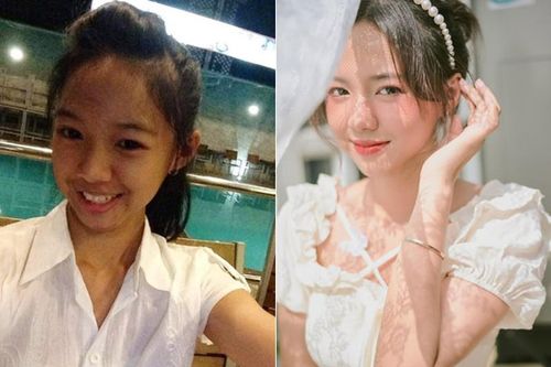 Bị bạn bè tẩy chay vì xấu, cô gái lột xác thành hot girl xinh đẹp