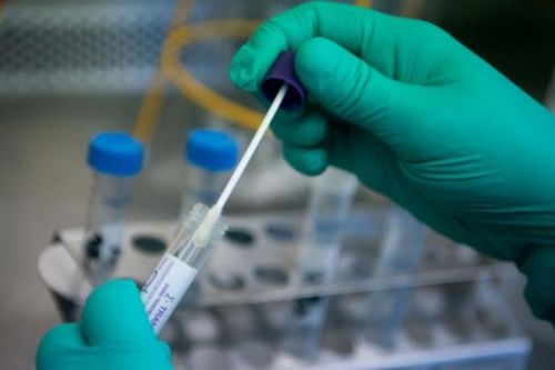 Sở Y tế TP. HCM từng chấp thuận cho Công ty Việt Á triển khai sàng lọc Covid-19 tại các quận, huyện