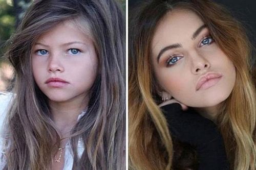 Sau 13 năm, bé gái mặt đẹp nhất hành tinh nhan sắc kém, thân mật quá đà với bạn trai