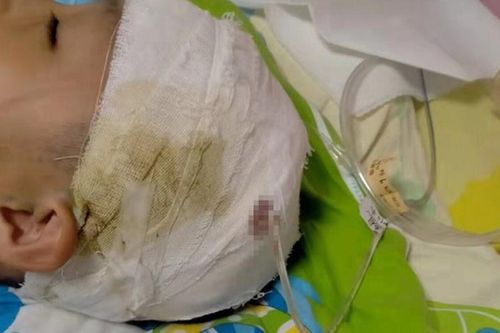 Nam sinh 10 tuổi nhập viện trong tình trạng vỡ mạch máu não sau khi bị thầy Hiệu trưởng đánh ở trường