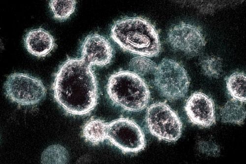 Virus SARS-CoV-2 có thể trú ẩn trong nội tạng hàng trăm ngày
