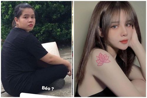Cô gái nấm lùn Tuyên Quang 'dậy thì thành công' xinh như hot girl