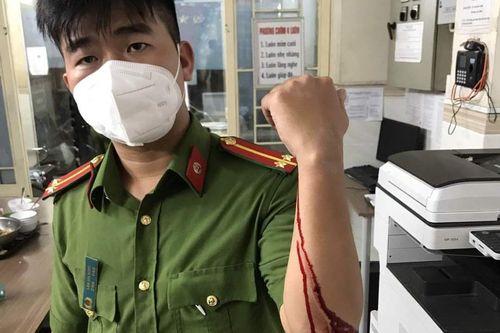 Cảnh sát khu vực ở TP.HCM bị tấn công khi tuần tra