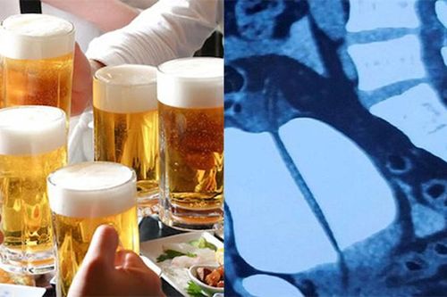 Sau cuộc nhậu, nam thanh niên phải cấp cứu vì bị vỡ bàng quang
