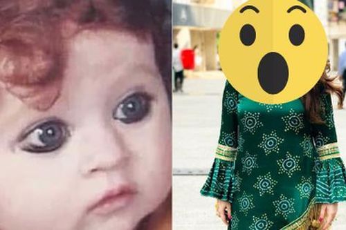Sinh ra bị cả làng xa lánh, chế giễu là 'quái vật' vì ngoại hình khác lạ, hơn 20 năm sau cô gái khiến ai nấy sững sờ vì nhan sắc hiện tại