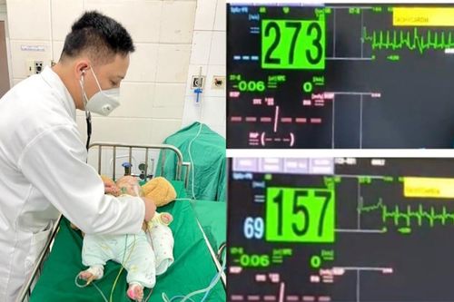 Cứu sống bé 2 tháng tuổi bị bệnh lý tim mạch cực kỳ nguy hiểm