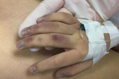 Vụ bé gái 6 tuổi ở Hà Nội tử vong: Bố đánh trong lúc kèm học gây sốc chấn thương, trào ngược thức ăn