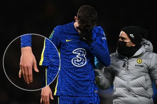 Havertz vẫn thi đấu dù bị gãy ngón tay