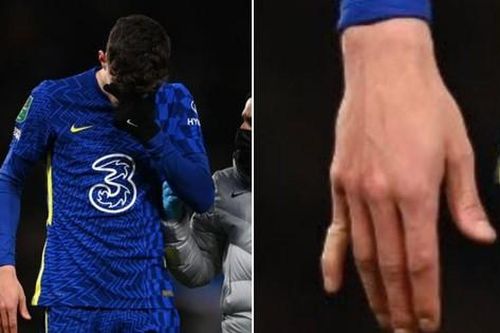 Ngôi sao Chelsea gãy ngón tay sau khi ghi bàn, cắn răng thi đấu hết hiệp 1