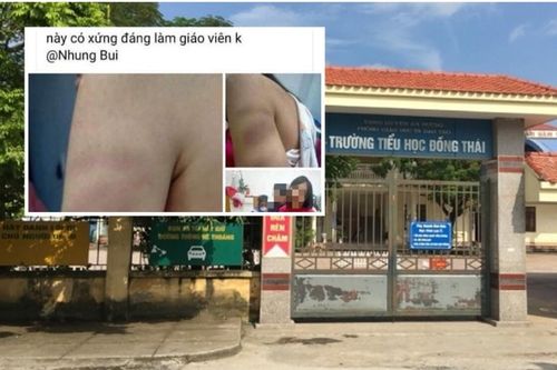 Dùng thước đánh tím tay học sinh lớp 1, cô giáo ở Hải Phòng bị đình chỉ dạy học một tuần