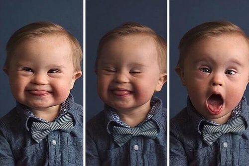 Hôn nhân cận huyết thống nguy hiểm như thế nào?