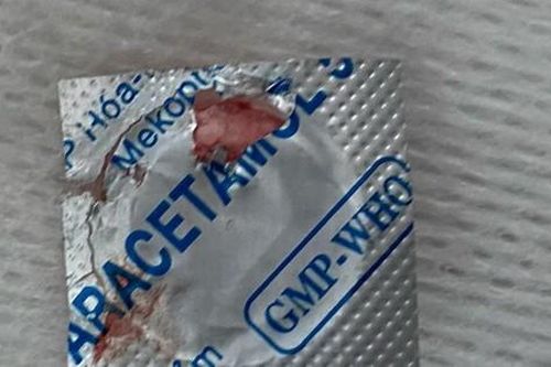 Viên thuốc còn nguyên vỏ kẹt ở thực quản bé trai 13 tuổi