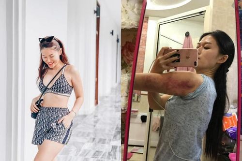 Đăng ảnh 'bầm dập', ái nữ đại gia thủy sản xảy ra chuyện gì