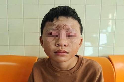 Cảnh báo hành vi học sinh tự chế tạo pháo nổ đế sử dụng trong dịp Tết
