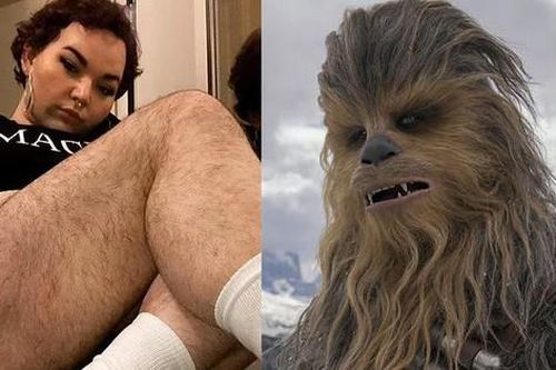 Cô gái mọc lông khắp cơ thể bị trêu chọc là Chewbacca trong phim 'Star Wars'