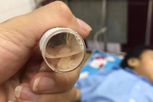 Bé gái 3 tuổi nghi bị bạo hành, có nhiều dị vật trong sọ não: Từng nhập viện nhiều lần trước đó