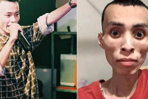 Nam rapper Việt qua đời vì bệnh ung thư ở tuổi 27: Cảnh báo loại ung thư nguy hiểm ai cũng có thể mắc, dấu hiệu bệnh dễ nhầm lẫn với 'bệnh vặt'
