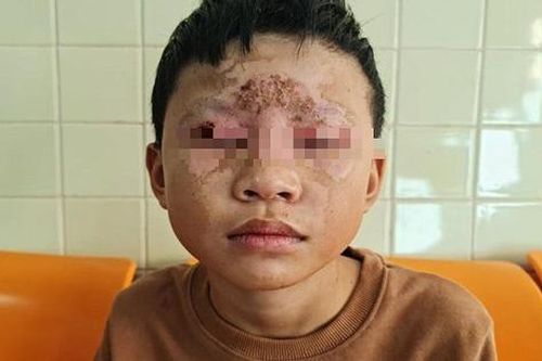 Ẩn họa khôn lường từ việc học sinh lên mạng học chế tạo pháo nổ