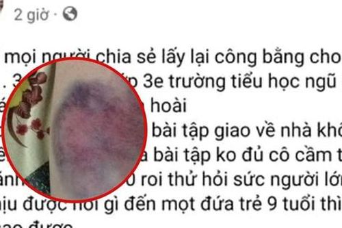 Công an vào cuộc xác minh vụ cô giáo ở Hải Phòng bị tố 'đánh thâm tím mông các học sinh'