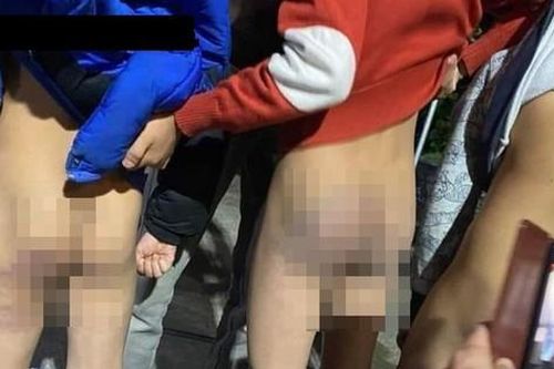 Mới nhất vụ bé trai lớp 3 ở Hải Phòng tố bị đánh 70 roi, thâm tím mông