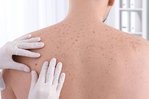 Vaccine ngừa ung thư da