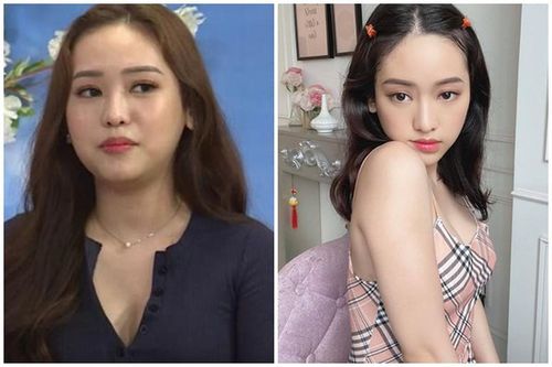 'Hot girl Cà Mau' giờ ra sao sau nhiều lần can thiệp thẩm mỹ?