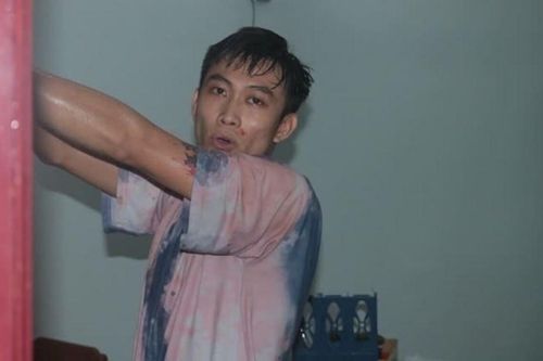 Nam thanh niên 'ngáo đá' dùng dao đâm trọng thương 3 người tại nhà trọ