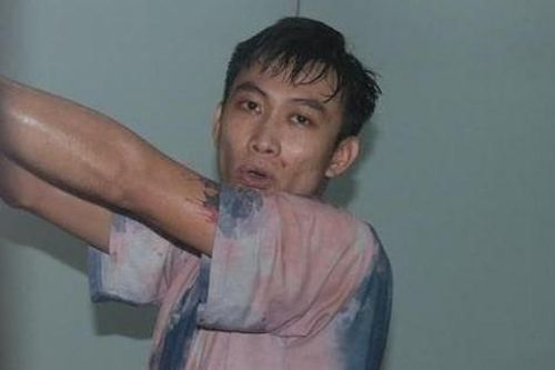 Thanh niên đánh vợ rồi chém loạn xạ người can ngăn khiến 3 nạn nhân nhập viện