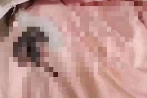 Trở lại phòng trọ sau kỳ nghỉ Tết, té xỉu vì 'vị khách lạ' xuất hiện trên giường