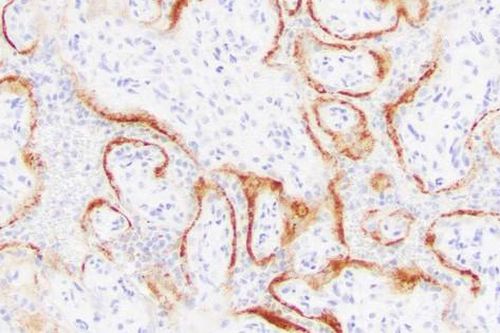 Coronavirus có thể phá hủy nhau thai và dẫn đến thai chết lưu