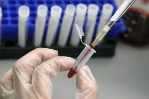 Người phụ nữ đầu tiên trên thế giới được chữa khỏi HIV bằng phương pháp cấy ghép tế bào gốc