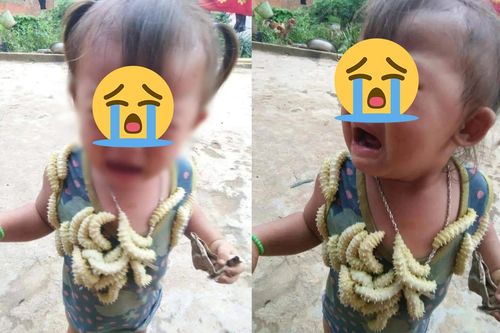 Bé gái bị thả chục con tằm bò khắp người, biểu cảm đáng thương dấy lên tranh cãi