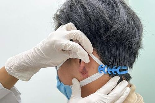 Chàng trai gánh hậu quả nặng nề vì sửa tai cho 'hợp phong thủy'