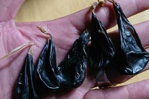 Cháu bé 9 ngày tuổi ngừng thở, tím tái khi gia đình cho uống mật khỉ