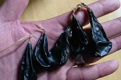 Cháu bé 9 ngày tuổi ngừng tim do uống mật khỉ