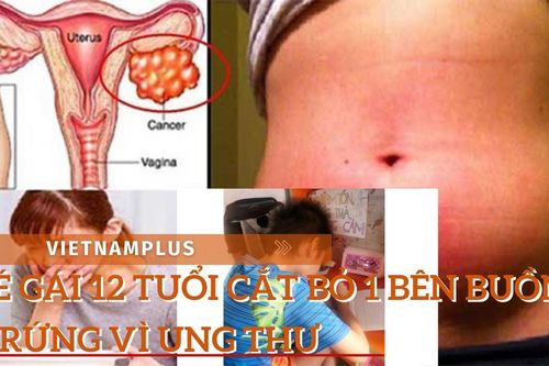Cuộc chiến với ung thư buồng trứng của cô bé 12 tuổi