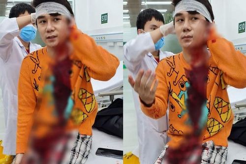 Chi tiết vụ diễn viên phim 'Thương ngày nắng về' bị chém